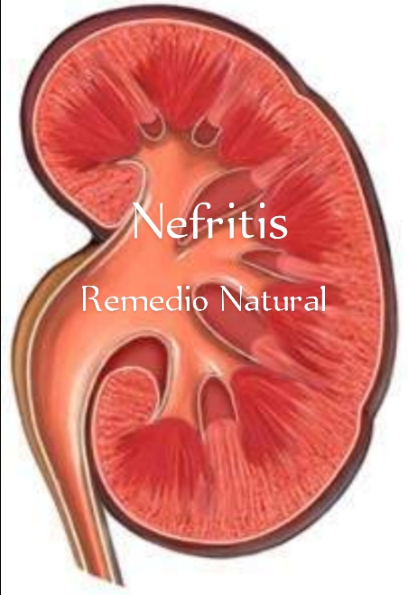 Remedio Natural Para La Nefritis