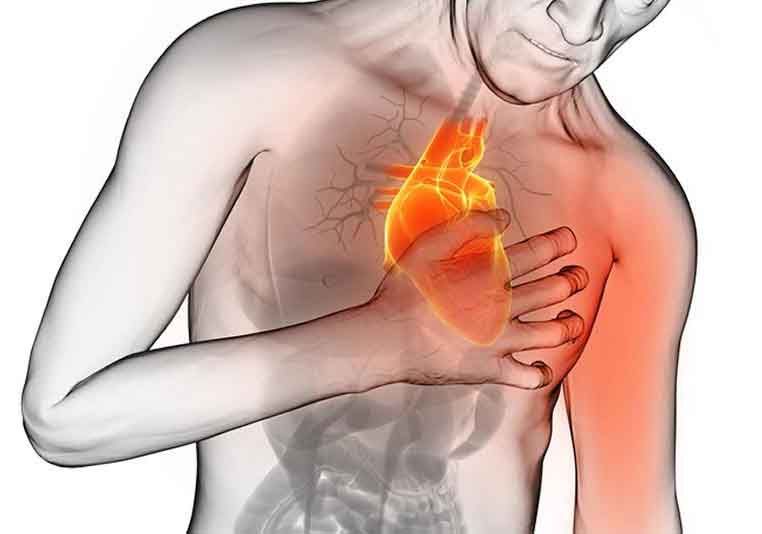 La Cardiopatía Isquémica Tratamiento Natural